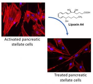 A lipid against pancreatic cancer: Reprogramming the tumor stroma-Medicine Innovates