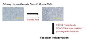 Saturated fatty acids induce inflammation in blood vessels - Medicine Innovates