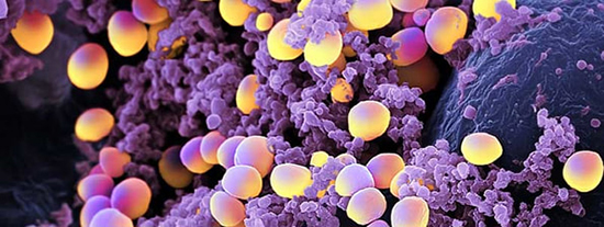 A probiotic sugar outcompetes Staphylococcus aureus - Medicine Innovates
