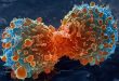 Metformin-panobinostat combination against bladder cancer-Medicine Innovates