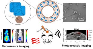 Stable J-Aggregation of an aza-BODIPY-Lipid in a Liposome for Optical Cancer Imaging - Medicine Innovates