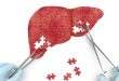 Targeting miR-144 a promising therapeutic strategy for the treatment of liver diseases in obese patients - Medicine Innovates