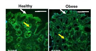Intestinal breast cancer resistance protein (BCRP) requires Janus kinase 3 activity for drug efflux and barrier functions in obesity - Medicine Innovates