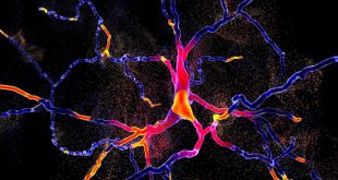 Reversing Parkinson’s disease by substituting dead Neurons - Medicine Innovates