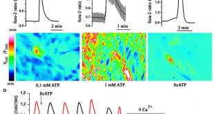Adenosine-5′-triphosphate suppresses proliferation and migration capacity of human endometrial stem cells - Medicine Innovates