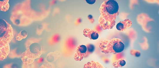 Breath-based biomarker detection using nanoparticle sensor system - Medicine Innovates