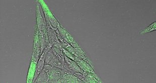 A new strategy for enzyme replacement therapy - Medicine Innovates