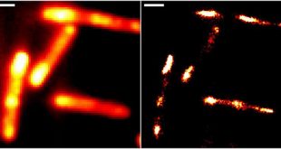 Enabling live-cell RNA imaging with unprecedented resolution - Medicine Innovates