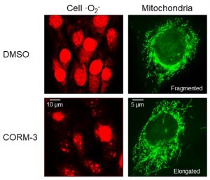 Skeletal muscle mitochondrial fragmentation and impaired bioenergetics from nutrient overload are prevented by carbon monoxide - Medicine Innovates