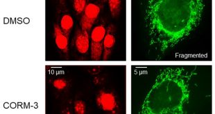 Skeletal muscle mitochondrial fragmentation and impaired bioenergetics from nutrient overload are prevented by carbon monoxide - Medicine Innovates
