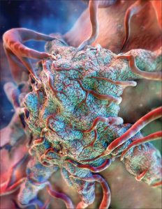 New Druggable Target for Pancreatic Cancer Discovered - Medicine Innovates