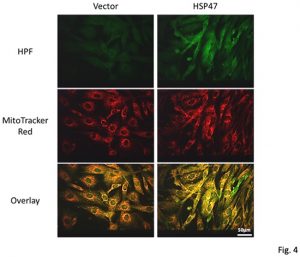 Translocation of HSP47 and generation of mitochondrial reactive oxygen species in human neuroblastoma SK-N-SH cells following electron and X-ray irradiation - Medicine Innovates