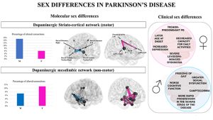 Gender differences in dopaminergic system dysfunction in de novo Parkinson's disease clinical subtypes - Medicine Innovates