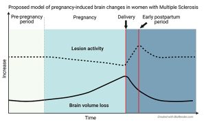 Pregnancy-induced brain magnetic resonance imaging changes in women with multiple sclerosis - Medicine Innovates