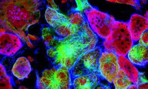 Rebecsinib reverses ADAR1-induced cancer stem cell cloning capacity - Medicine Innovates