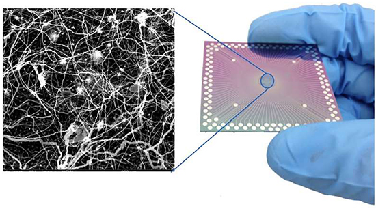 Developing brain-like functions from nanowire networks - Medicine Innovates