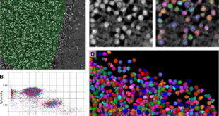 Neuronal Structural Alterations in Multiple Sclerosis - Medicine Innovates