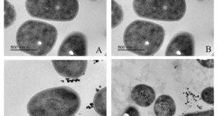 Arthrobacter sp. 24S4–2: A Potential Novel Species with Unique Nitrogen Metabolism in the Antarctic Environment - Medicine Innovates