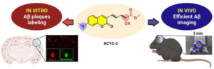 Coumarin-Based Fluorescent Probe: A new probe for the early detection and monitoring of Aβ plaques - Medicine Innovates