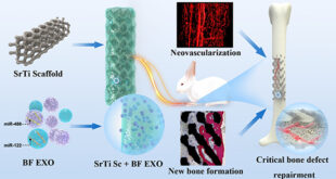 Advancing Bone Regeneration: Pioneering the Future with 3D-Printed Scaffolds and Serum Exosomes - Medicine Innovates