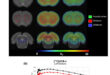Acute taVNS Reduces Presynaptic SV2A Density in Key Brain Regions Without Altering Glucose Metabolism: A MicroPET Study in Healthy Rats - Medicine Innovates